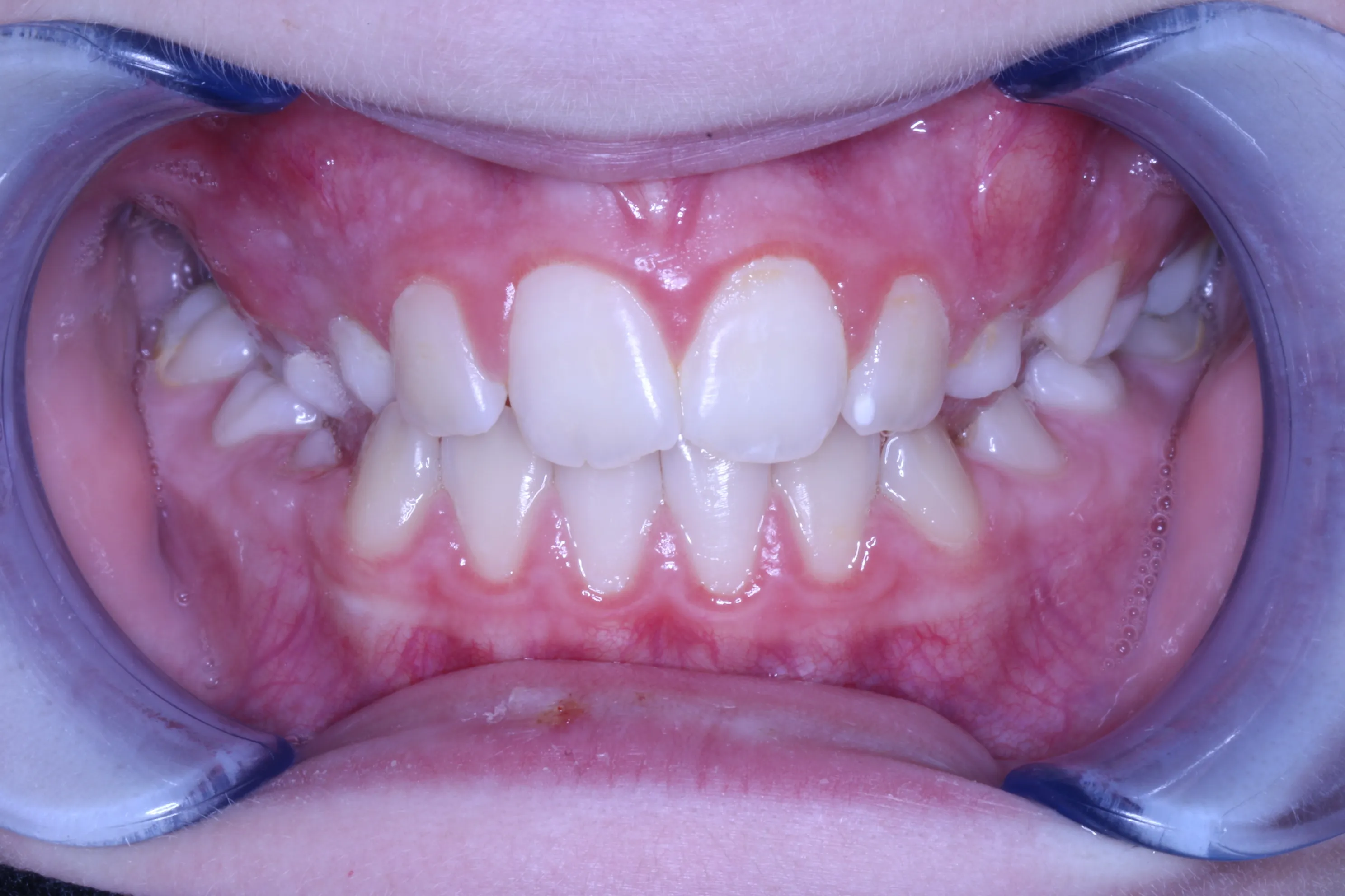 smile-gallery gallery